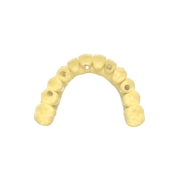 Comfortable Biocompatible Resin 3d Printing For Trial Crown And Bridge Restorations