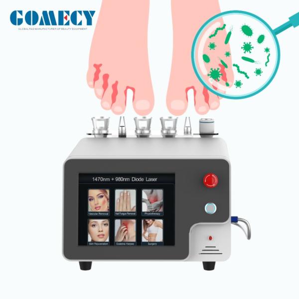 1470nm 980nm Laser Beauty Machine , Endolift Laser Machine For Skin Rejuvenation