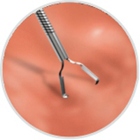 Продукты устранимого Эндоскопик зажима Хемо медицинские потребляемые 2 лет гарантии