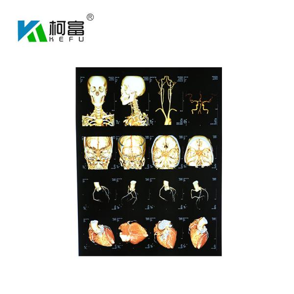 el laser impermeable X Ray Film de 210mmx297m m 150 micrones de OKI fotocopia a la impresora Film de Fuji