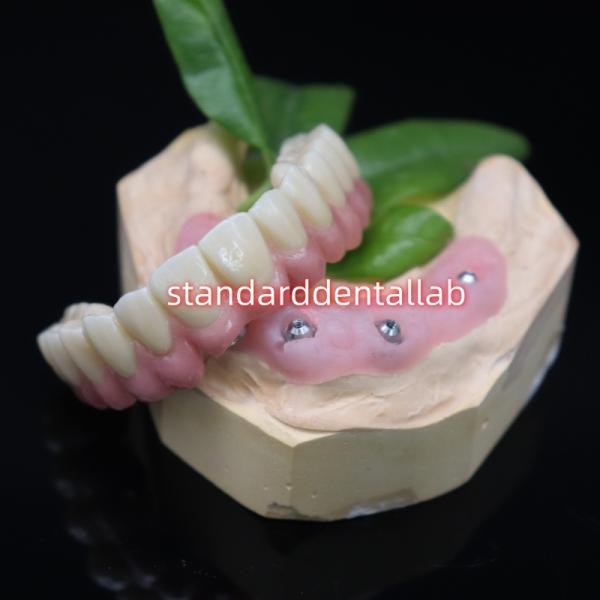 Todo atornillado en 6 Puente de zirconio completo Dental de alta precisión sobre la base de Ti