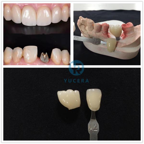 A1 A2 A3 A3 Pre затеняло кулачок Cad блоков Zirconia со значениями яркости