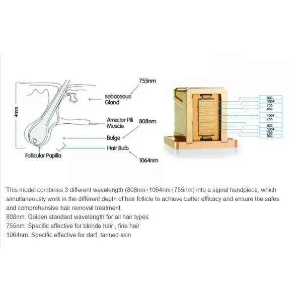 competitive price women underarm 755nm 808nm 1064nm laser hair removal machine
