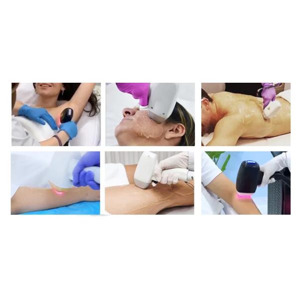 3 longueurs d'onde glacent l'Alexandrite Diodo Depilacion 755 808 1064 machines d'épilation de laser de diode