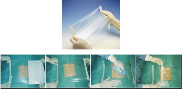 PU Surgical incision dressing with Iodine, disposable surgical drape with Iodine 30*45cm