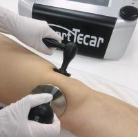 Máquina de la terapia del RF Diathmy Tecar para el Tendonitis plantar de Fasciitis