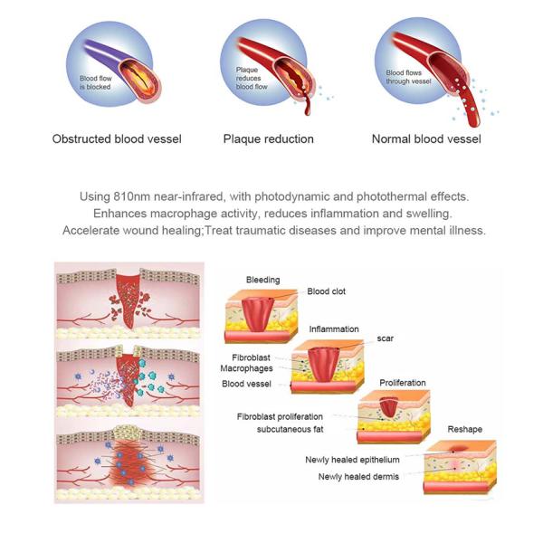 Вся кровать терапией красоты света СИД машины PDT терапией света тела красная с Irradiance ² 80 MW/Cm