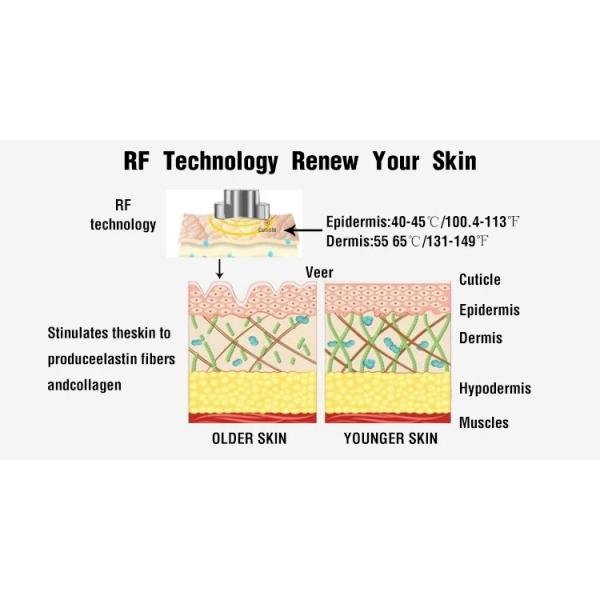 Лифтинг лица EMs RF удаление морщин и лифтинг кожи красота машина