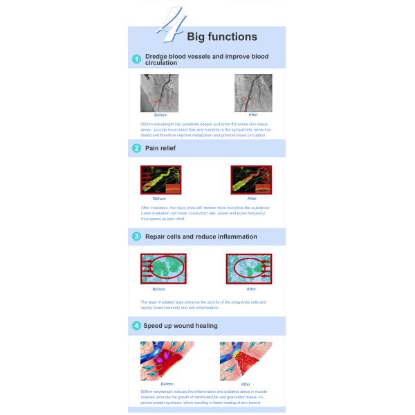 Прибор терапией лазера облегчения боли LLLT портативный Handheld для задней боли плеча