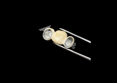 Precise Fit Porcelain Fused To Metal Crown With Excellent Biocompatibility