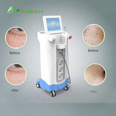 980nm Diode Laser Spider Vein Removal Machine For Blood Spider clearance