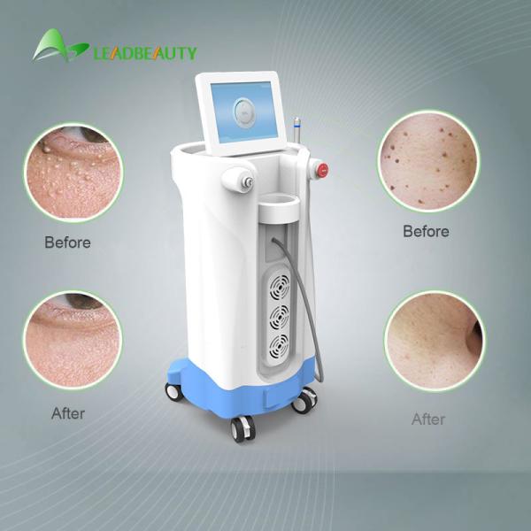 980nm Diode Laser Spider Vein Removal Machine For Blood Spider clearance