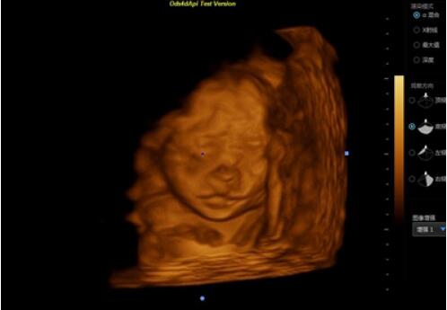 Покрасьте оборудование ультразвука машины ультразвука Допплер медицинское с 5 языками видов