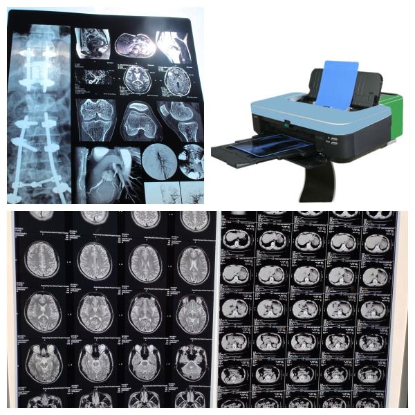 10inch Inkjet Color X Ray Film For Medical Imaging 210 Microns