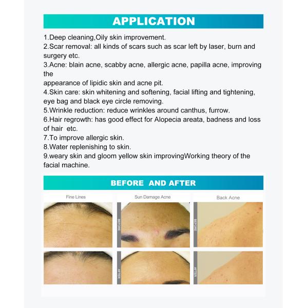 10 в 1 корке лицевом SPA24 двигателя машины 110V Microdermabrasion