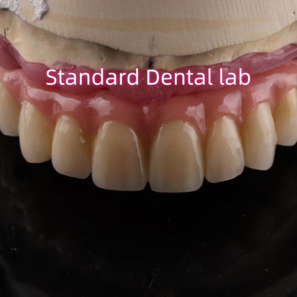 Zirconia Implant Bridge Screw Retained With Pink Gum Porcelain
