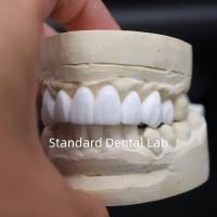 Des couronnes dentaires pour le diagnostic, la cirée esthétique, du laboratoire dentaire chinois.
