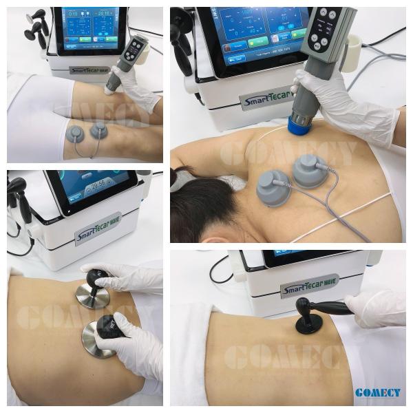 Tecar Therapy Device Non-Invasive Solution for Pain Relief and Enhanced Recovery Machine