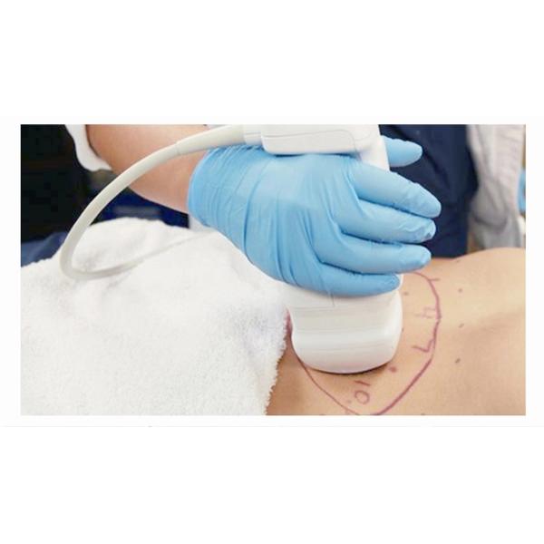 Effective Ultrasound Face Lift Machine One Handpiece Harmless To Tissue Outside