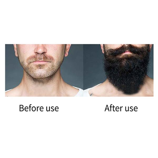 Органическая сыворотка роста волос на лице сыворотки 30ml роста волос бороды