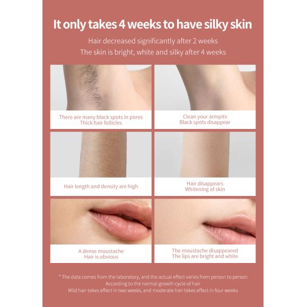 Машины удаления Epilator волос лазера Ipl льда прибор перевозчика волос крутой постоянный безболезненный