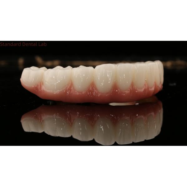 Высококачественная зубная цирконовая корона и All On Four Six Implant Full Arch / Китайская стоматологическая лаборатория