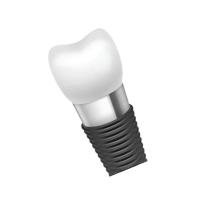 Barras del implante dental: Fuerza y estabilidad incomparables