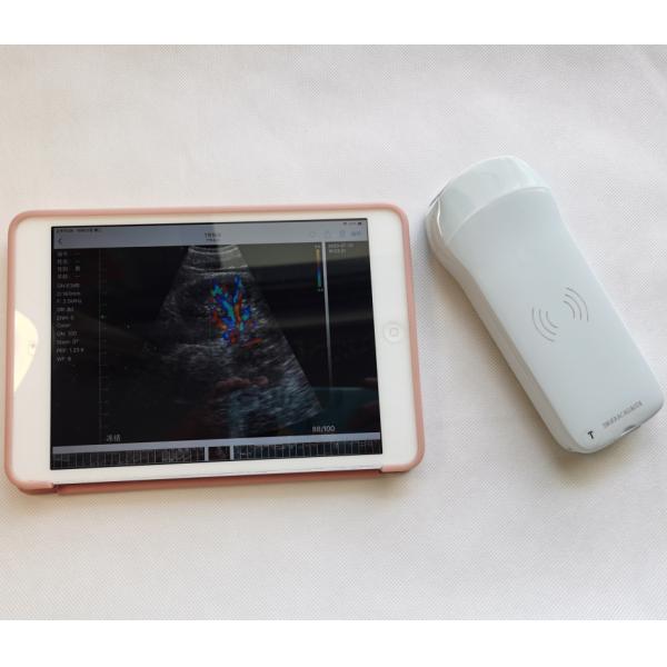 Usg New Look 3d Image GYN Image Laptop Ob Gyn Fetal Ultrasound Machine Color Doppler With High Quality