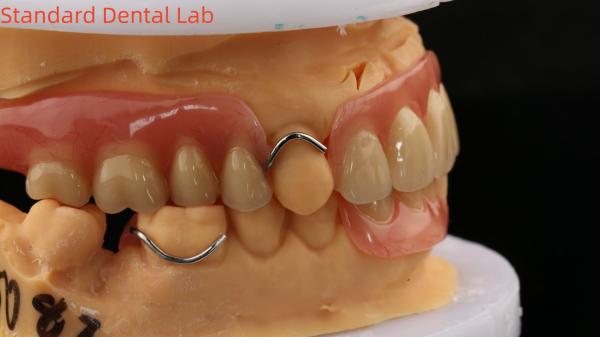 Dentures en acrylique complète ISO avec des dents d'or jaune