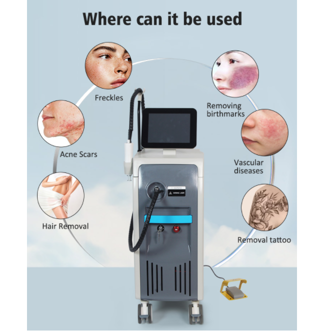 Dual Wavelength 755nm 1064nm Alexandrite Long Pulse Nd Yag Laser Hair Removal Machine