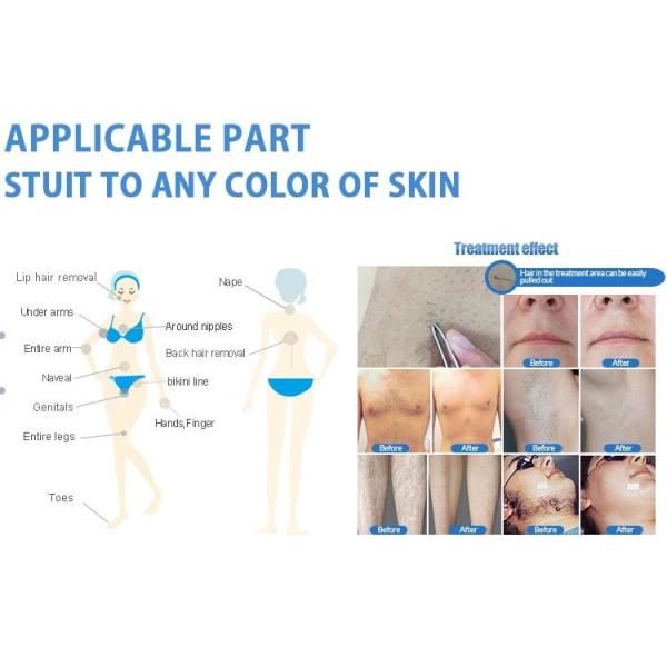 машина 755 удаления волос лазера диода платины льда сопрано 3000W 808 1064