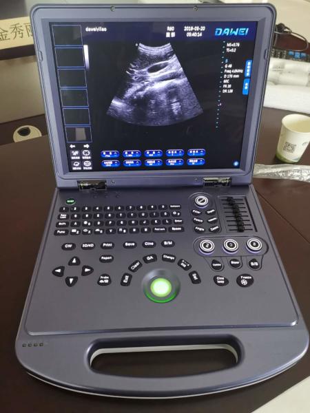 CE Portable Ultrasonic Diagnostic System 4d Color Doppler Ultrasound 300mm