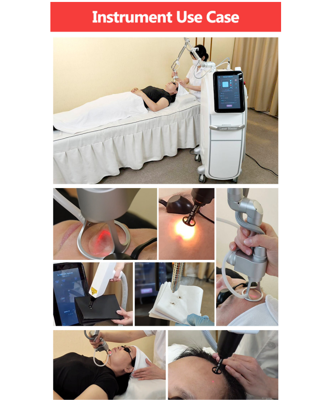 2 In 1 Fractional CO2 Nd Yag Laser Tattoo Removal Machine Vaginal Tightening Beauty Equipment