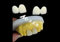 Coroa Dental de Circônio Personalizada Capuz Dental de Adequação Precisa do Laboratório Dental da China
