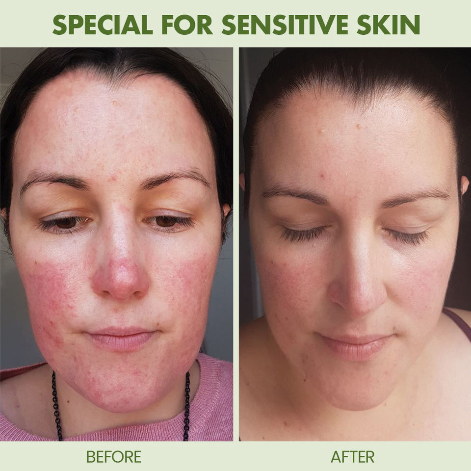 OEM ODM brand organic pure toner Sensitive skin care product Anti redness, anti allergy, moisturizing facial toner spray soothing agent