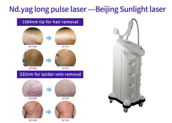 Long Pulse Nd Yag Laser Hair Removal Machine Spider Vein Removal With Skin Rejuvenation