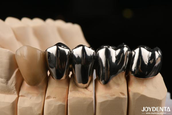 Oral Clinical Repair FMC Full Metal Crown Made With Wax Casting Production Method