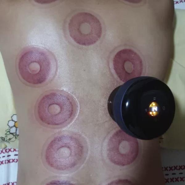 Anti-Cellulite Therapy Device Electric Vacuum Cupping Therapy for Body Guasha Scraping