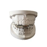 Conception de haute résistance des appareils orthodontiques dentaires 3D Digital d'OEM