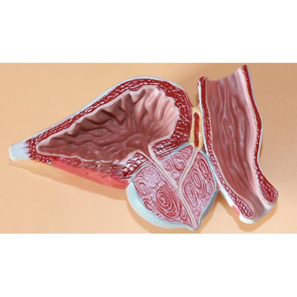 Human Anatomy PVC Simulation Human Pathology Prostate Model For Medical Educational