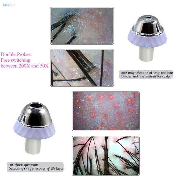 Za Plugs Tipo de folículo capilar Scanner para cara/cabeça e máquina de análise de cabelo do couro cabeludo