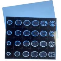 Dry Medical Film for Inkjet Printer Blue Base Medical X-ray Film