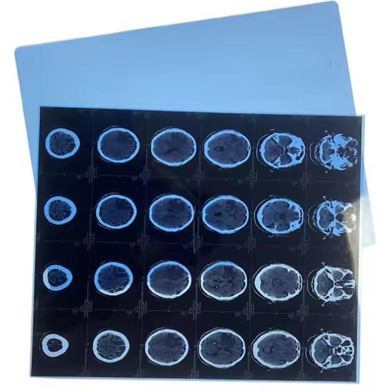 Inkjet Medical X-ray Film Compatible With Canon HP And Epson Inkjet Film Printer