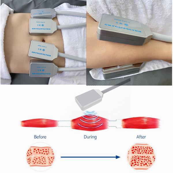 Машина красоты машины стимулированием Muslce замерзая машины Cryolipolysis жирная электрическая для потери веса