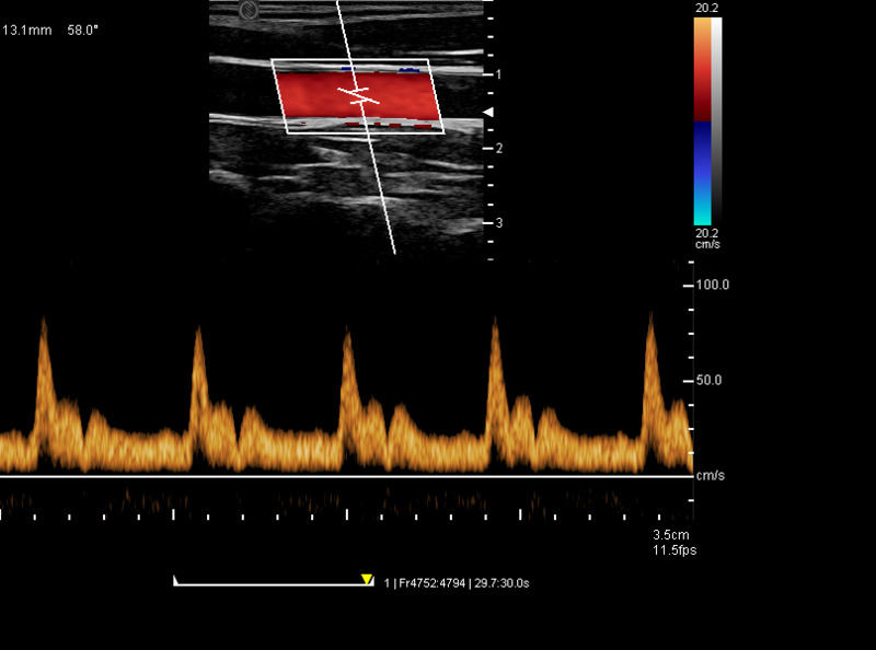 Hospital Outside Trolley 15Inch Ultrasound Machine Ultrasound Digital Color Doppler Ultrasound Machines edical