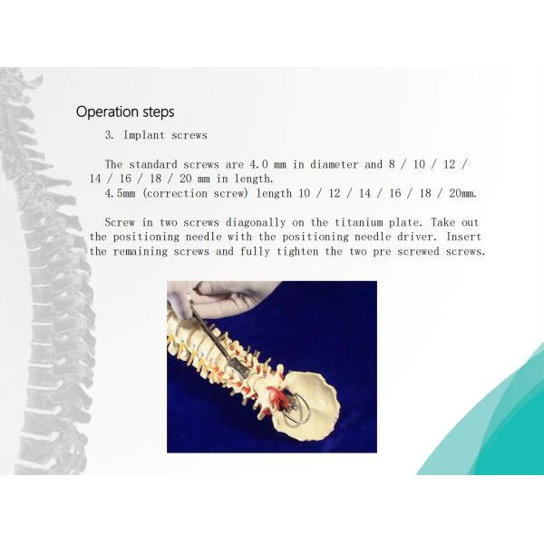 Spine Anterior Cervical Plate Titanium Cervical Plate Implant Orthopedic Surgery CE Certification