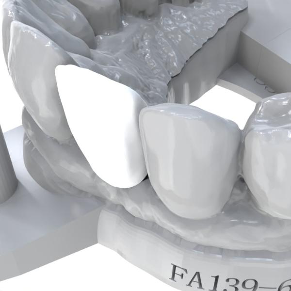 Strong Adhesion Permanent Crown Resin High Strength Long-Lasting Restorations