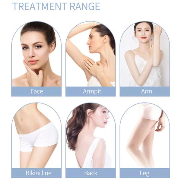 Body Permanent 808nm Diode Ipl Laser Hair Removal Machine Skin Rejuvenation Device