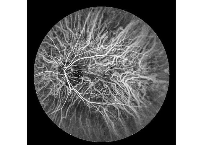 Оборудование камеры Fundus сканирования лазера профессиональное офтальмическое с Fundus отображая размер зрачка FOV 160° минимальный 2 mm