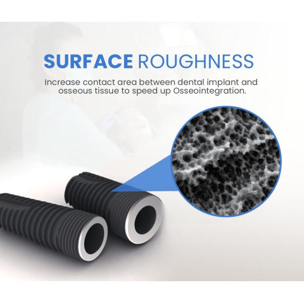 2D/3D Customized Dental Implant Prosthetic Abutment for Narrow Regular Neck Implants